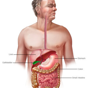 Triệu chứng tiêu chảy